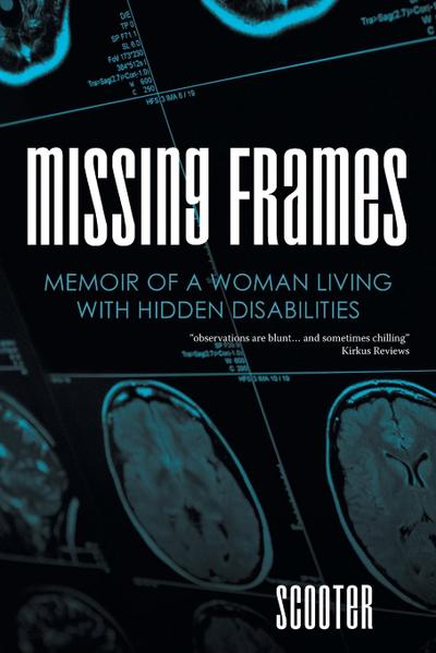 Missing Frames