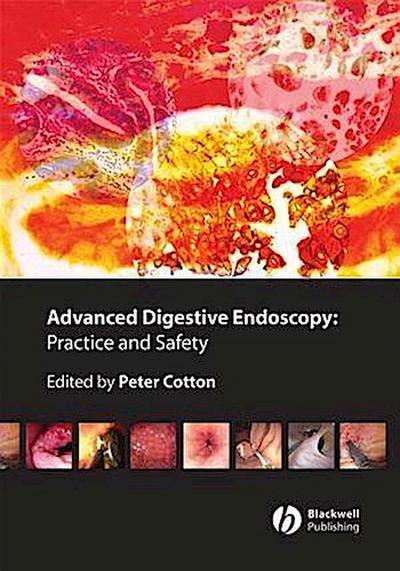Advanced Digestive Endoscopy