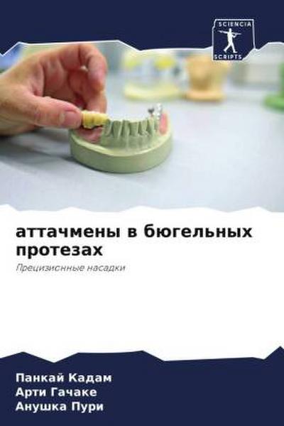 attachmeny w bügel’nyh protezah