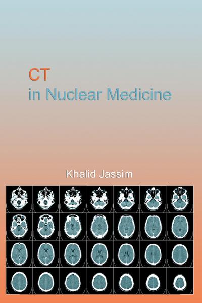 CT in Nuclear Medicine