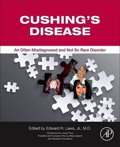 Cushing’s Disease