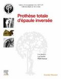 Prothese totale d’epaule inversee
