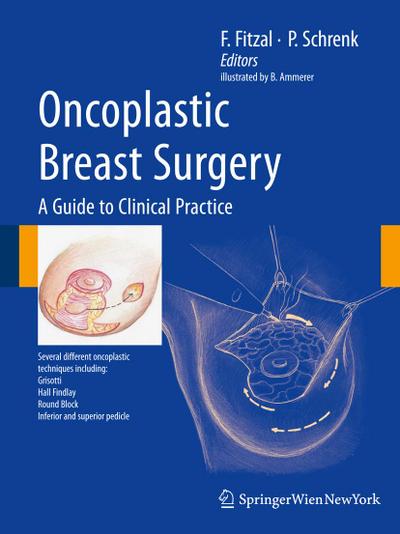 Oncoplastic Breast Surgery