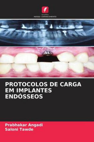 PROTOCOLOS DE CARGA EM IMPLANTES ENDÓSSEOS