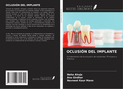 OCLUSIÓN DEL IMPLANTE