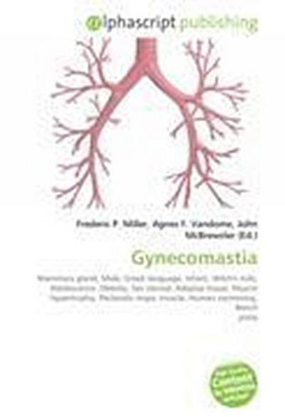 Gynecomastia