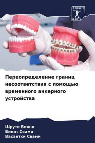 Pereopredelenie granic nesootwetstwiq s pomosch’ü wremennogo ankernogo ustrojstwa