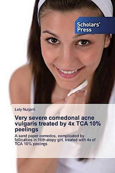 Very severe comedonal acne vulgaris treated by 4x TCA 10% peelings