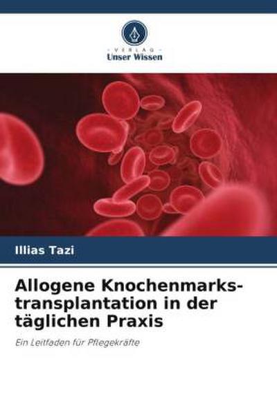 Allogene Knochenmarks-transplantation in der täglichen Praxis