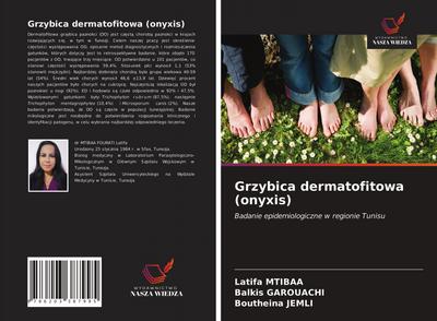 Grzybica dermatofitowa (onyxis)