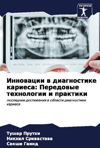 Innowacii w diagnostike kariesa: Peredowye tehnologii i praktiki