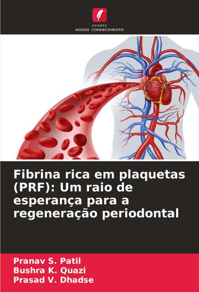 Fibrina rica em plaquetas (PRF): Um raio de esperança para a regeneração periodontal