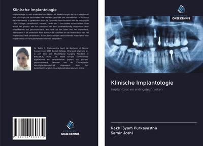 Klinische Implantologie