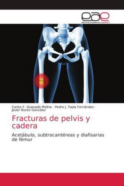 Fracturas de pelvis y cadera