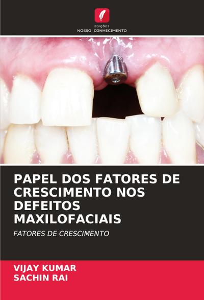 PAPEL DOS FATORES DE CRESCIMENTO NOS DEFEITOS MAXILOFACIAIS