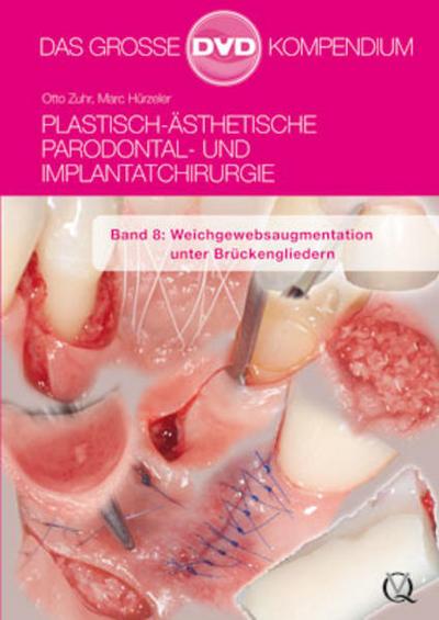 Plastisch-Ästhetische Parodontal- und Implantatchirurgie / Plastisch-Ästhetische Parodontal- und Implantatchirurgie