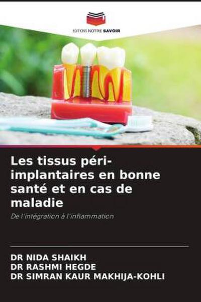 Les tissus péri-implantaires en bonne santé et en cas de maladie
