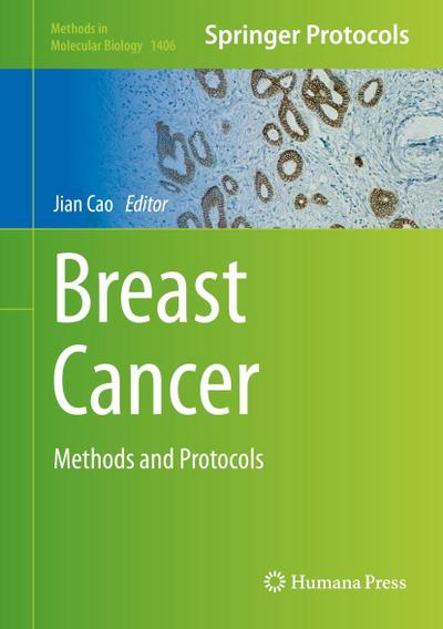 Breast Cancer