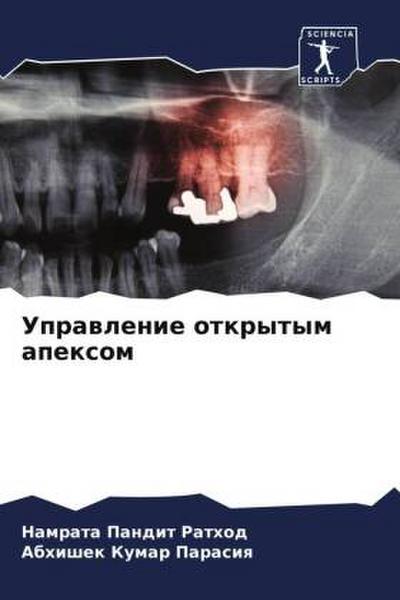 Uprawlenie otkrytym apexom