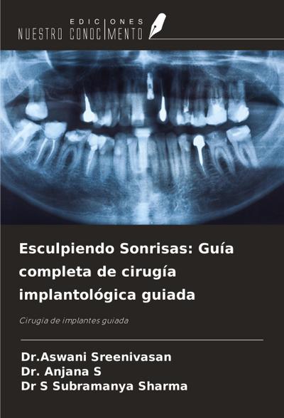 Esculpiendo Sonrisas: Guía completa de cirugía implantológica guiada