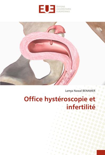 Office hystéroscopie et infertilité