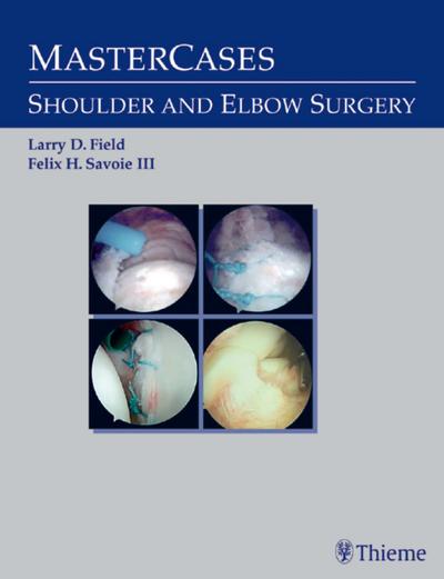 Master Cases, Shoulder and Elbow Surgery