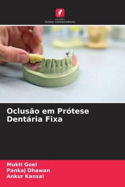 Oclusão em Prótese Dentária Fixa