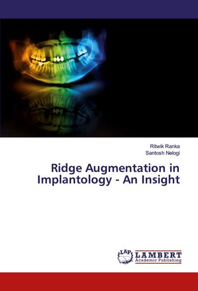 Ridge Augmentation in Implantology - An Insight