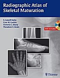 Radiographic Atlas of Skeletal Maturation