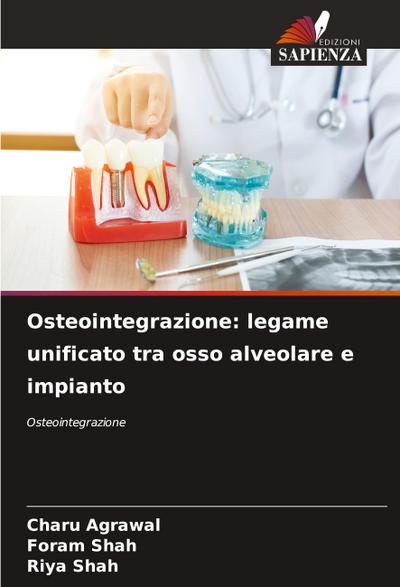 Osteointegrazione: legame unificato tra osso alveolare e impianto