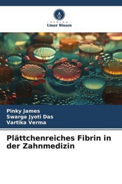 Plättchenreiches Fibrin in der Zahnmedizin