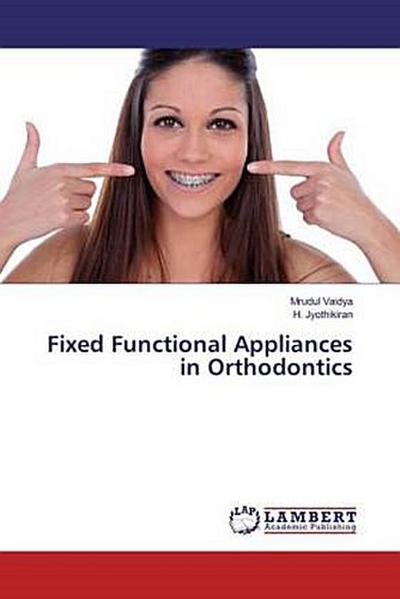 Fixed Functional Appliances in Orthodontics