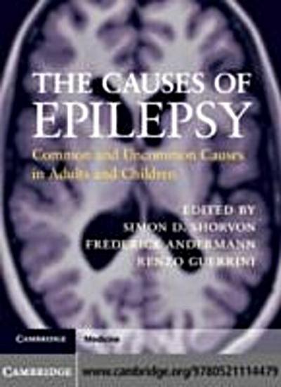 Causes of Epilepsy