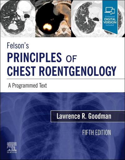 Felson’s Principles of Chest Roentgenology, A Programmed Text