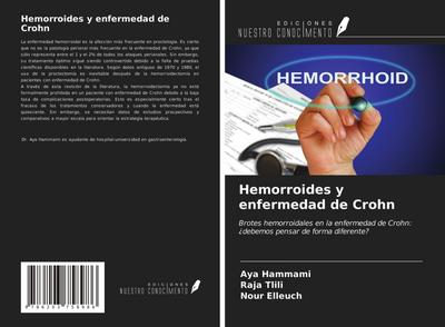 Hemorroides y enfermedad de Crohn