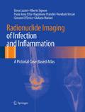 Radionuclide Imaging of Infection and Inflammation