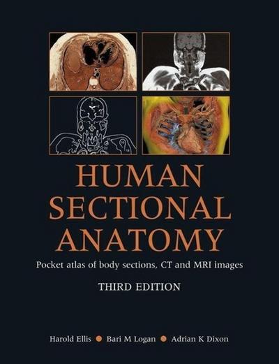 Human Sectional Anatomy