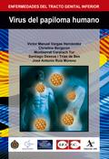 Virus del papiloma humano