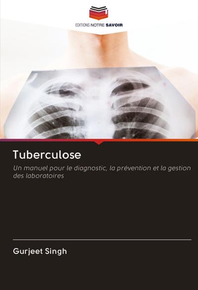 Tuberculose