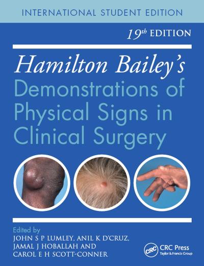 Hamilton Bailey’s Physical Signs