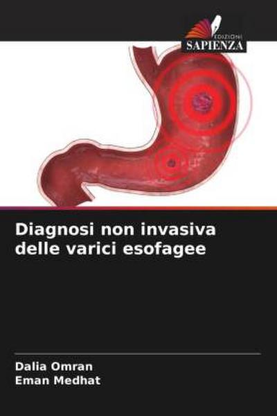 Diagnosi non invasiva delle varici esofagee