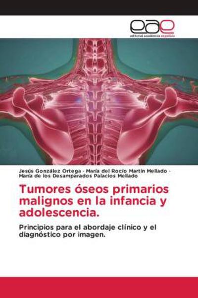 Tumores óseos primarios malignos en la infancia y adolescencia.
