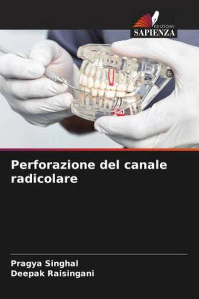 Perforazione del canale radicolare