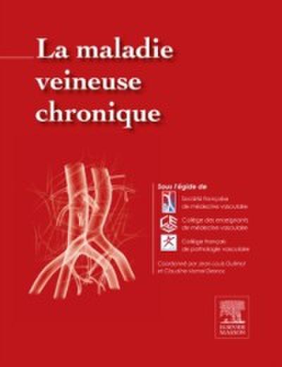 La maladie veineuse chronique