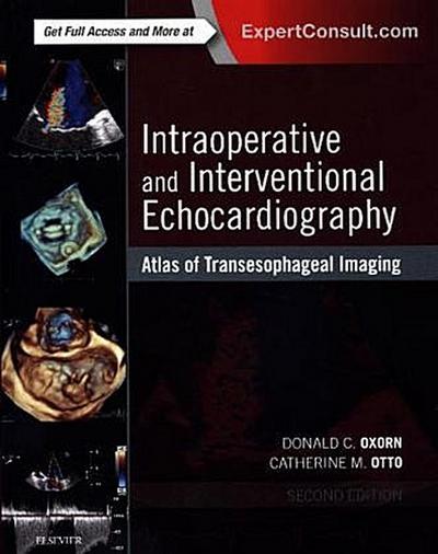 Intraoperative and Interventional Echocardiography