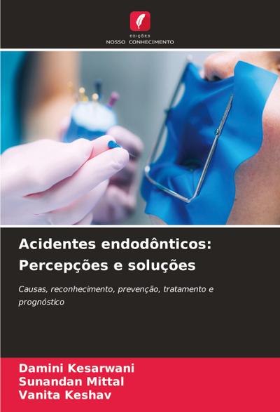 Acidentes endodônticos: Percepções e soluções