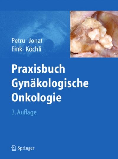 Praxisbuch Gynäkologische Onkologie