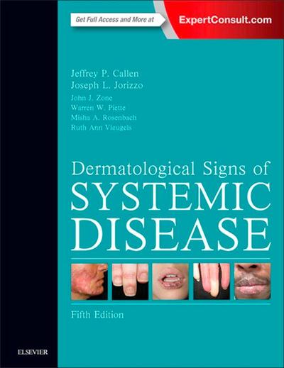 Dermatological Signs of Systemic Disease E-Book