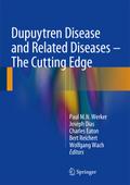 Dupuytren Disease and Related Diseases - The Cutti