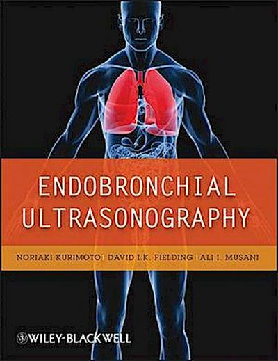 Endobronchial Ultrasonography